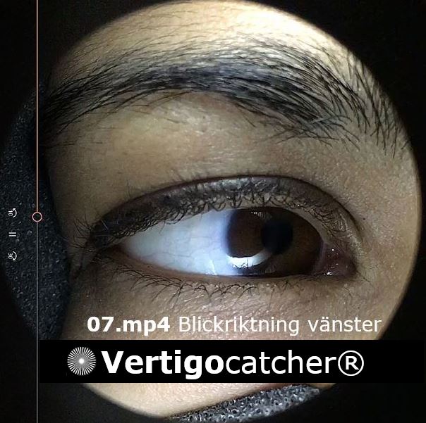 Vertigocatcher diagnostik av ögonrörelser vid yrsel