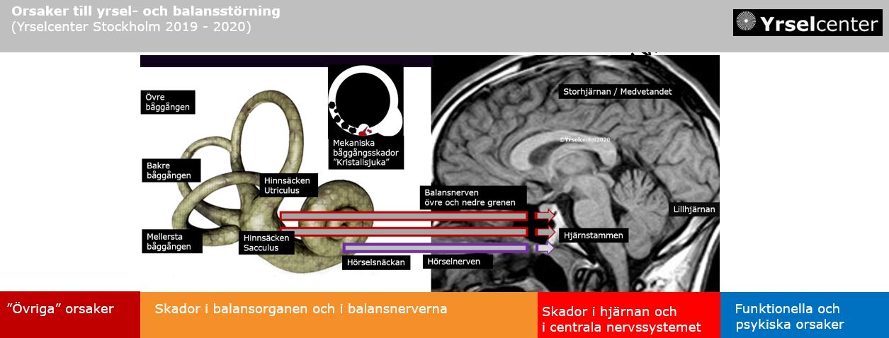 Yrsel orsaker Yrselcenter Stockholm